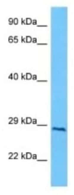 NT5M Rabbit anti-Human, Polyclonal, Novus Biologicals 100 &mu;g; Unconjugated:Antibodies,